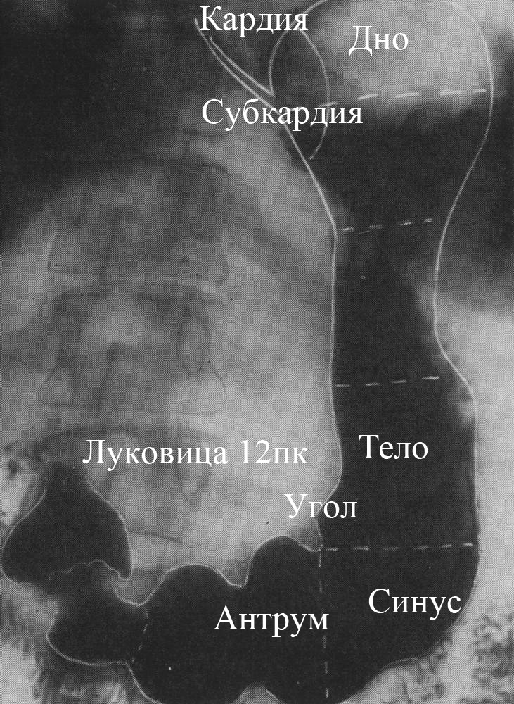 Рентгеноанатомия тонкой кишки